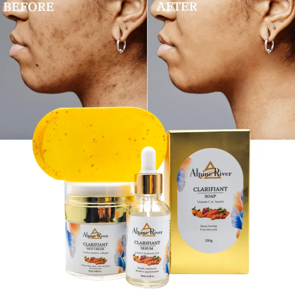 Pack Routine Éclat Anti-Taches "Clarifiant" – Alpine River (Savon + Sérum + Crème)